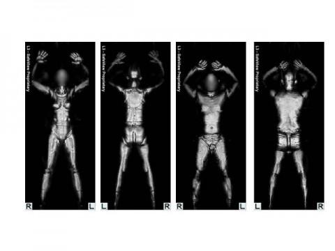 Images from Backscatter Full Body Imaging Device